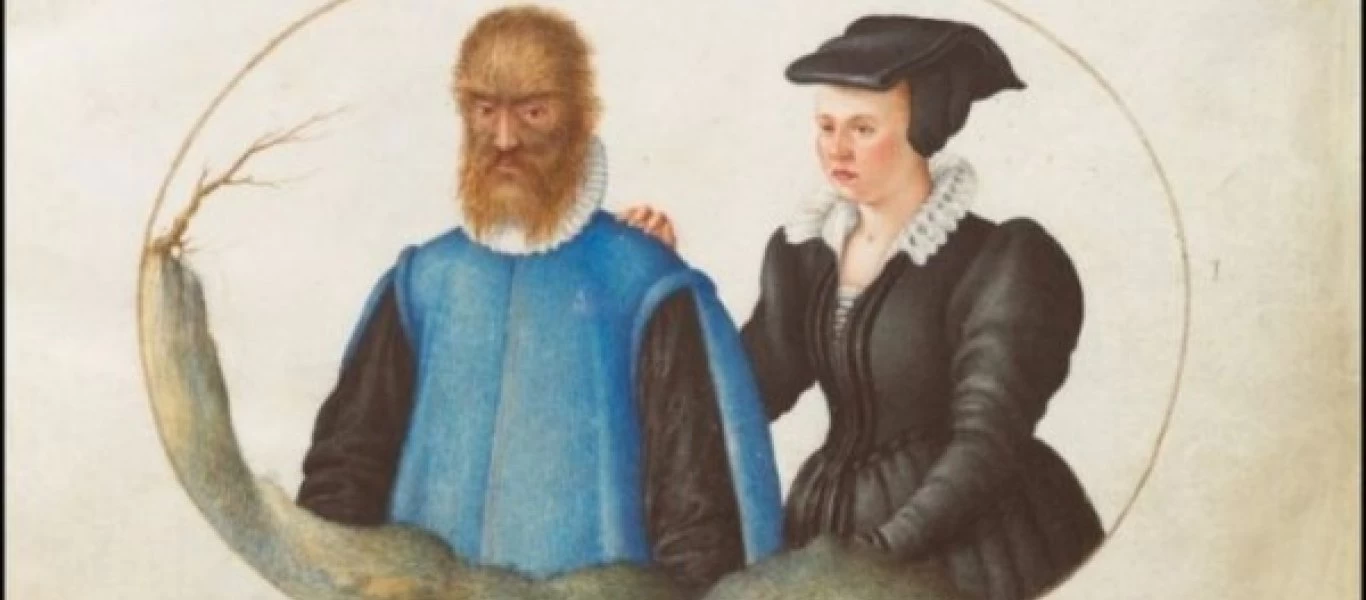 Αυτή είναι η αληθινή ιστορία πίσω από την «Πεντάμορφη και το Τέρας»